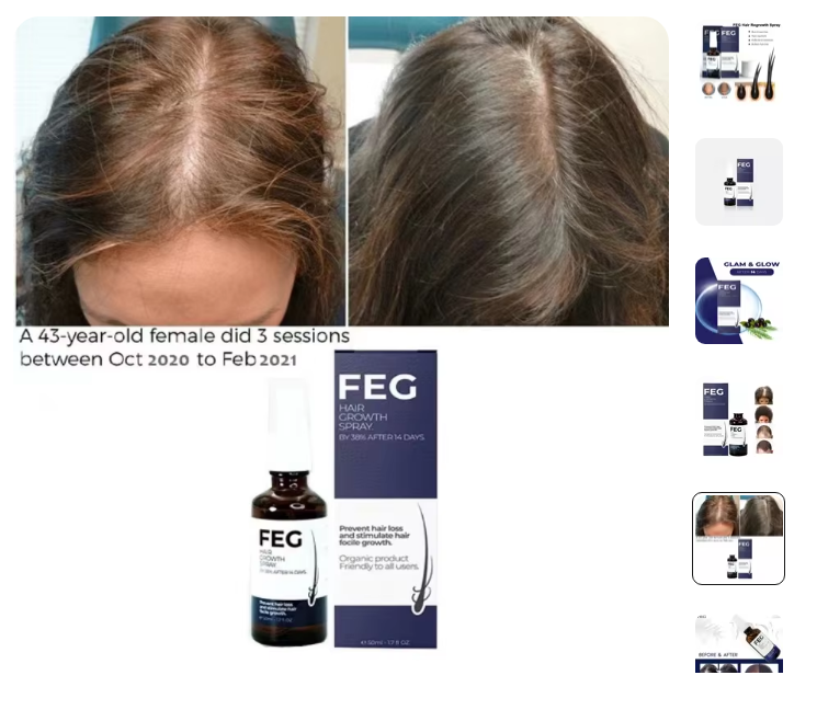 Load image into Gallery viewer, Hair Growth Spray
